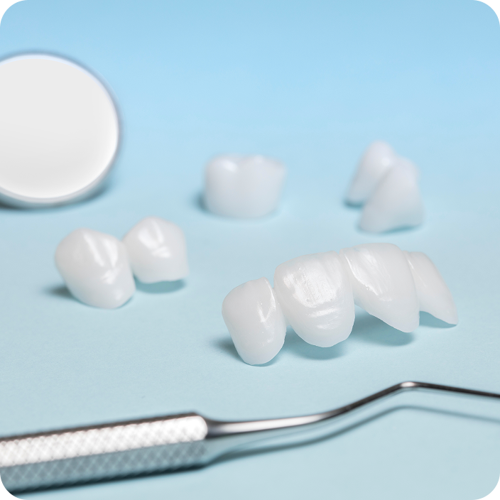 審美補綴(オールセラミック)