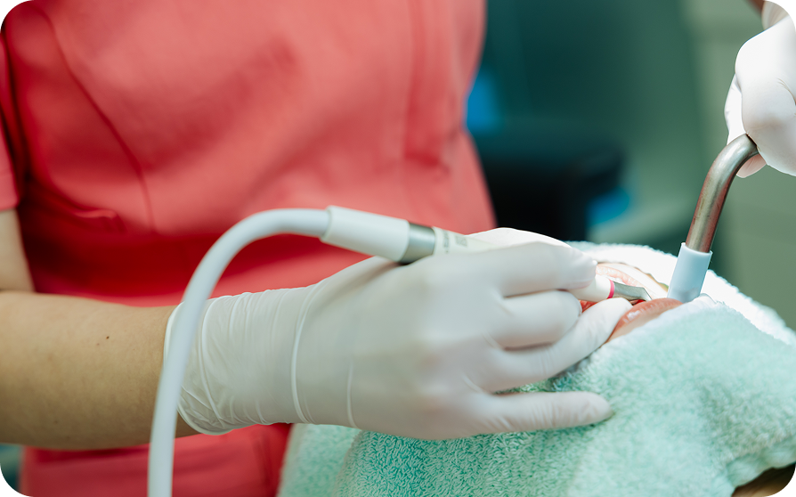 エアフロー予防・治療がおすすめの人