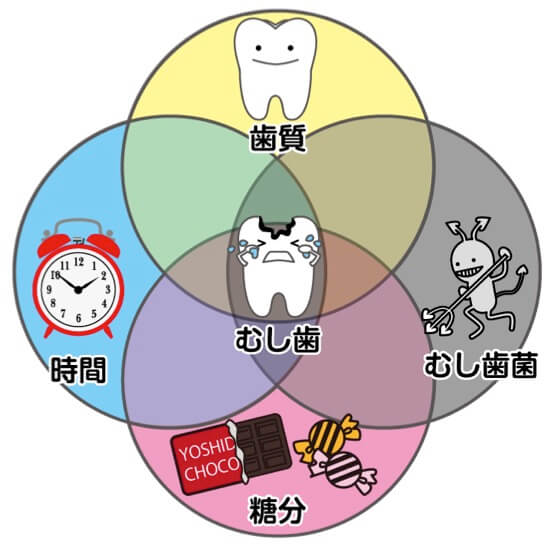 虫歯の原因