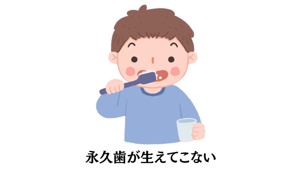 乳歯 生え変わり 永久歯 生えてこない