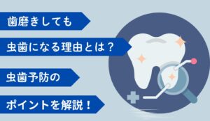 歯磨き　虫歯予防　歯磨きしても虫歯になる
