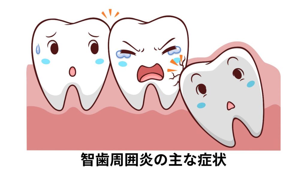 智歯周囲炎　症状