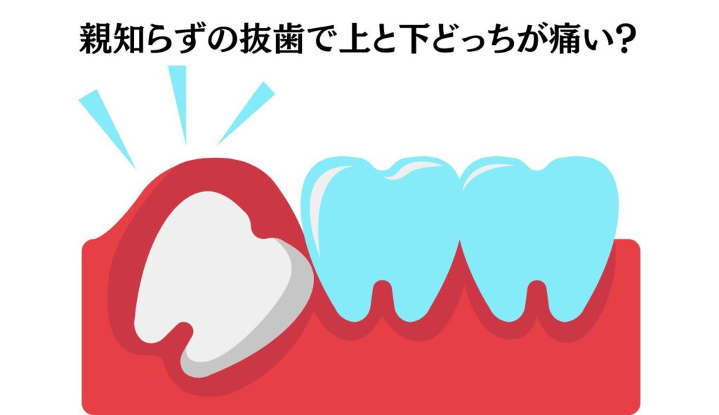 親知らず　抜歯　上と下　どっちが痛い